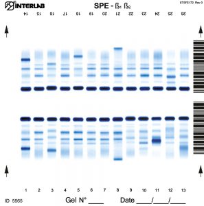 Serum Proteins and Concentrated Urine/CSF