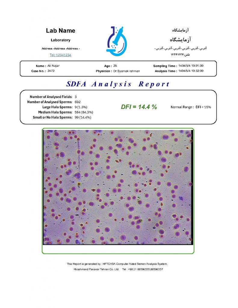 Sperm SDFA report