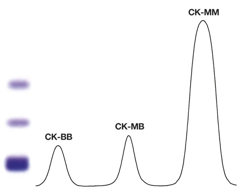 الکتروفورز CK ISOENZYMES