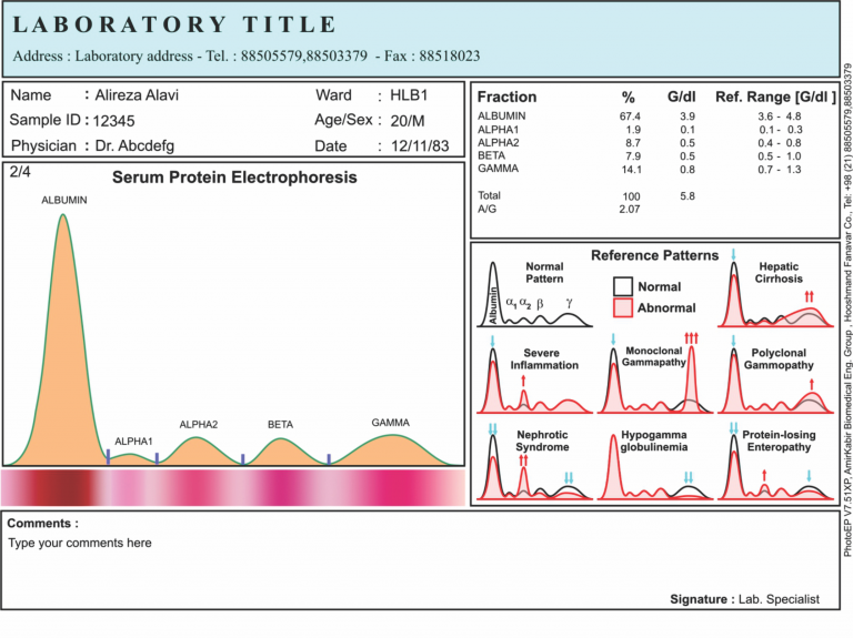 PhotoEP Electrophoresis Densitometry
